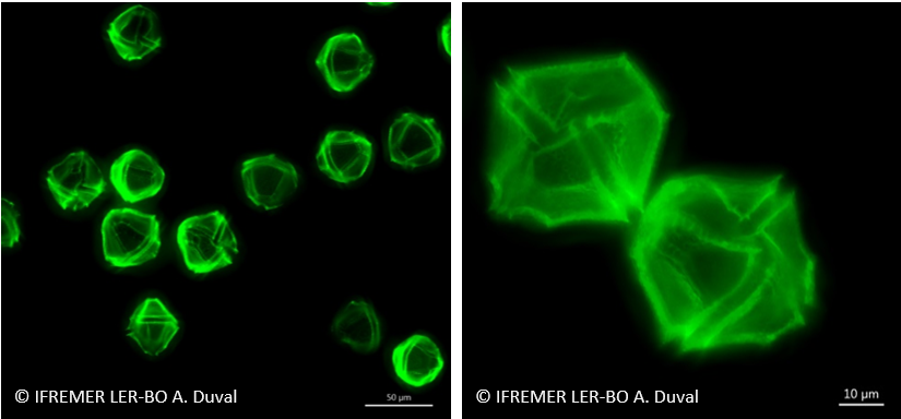 Lingulodinium polyedra au microscope à épifluorescence. Le marquage fluorescent vert permet de visualiser la thèque (enveloppe qui entoure la cellule), dont les motifs contribuent à identifier l’espèce
